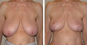 Before & After Photos